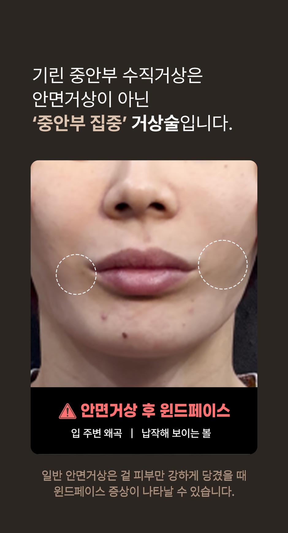 중안부수직거상_미인하이_03.jpg
