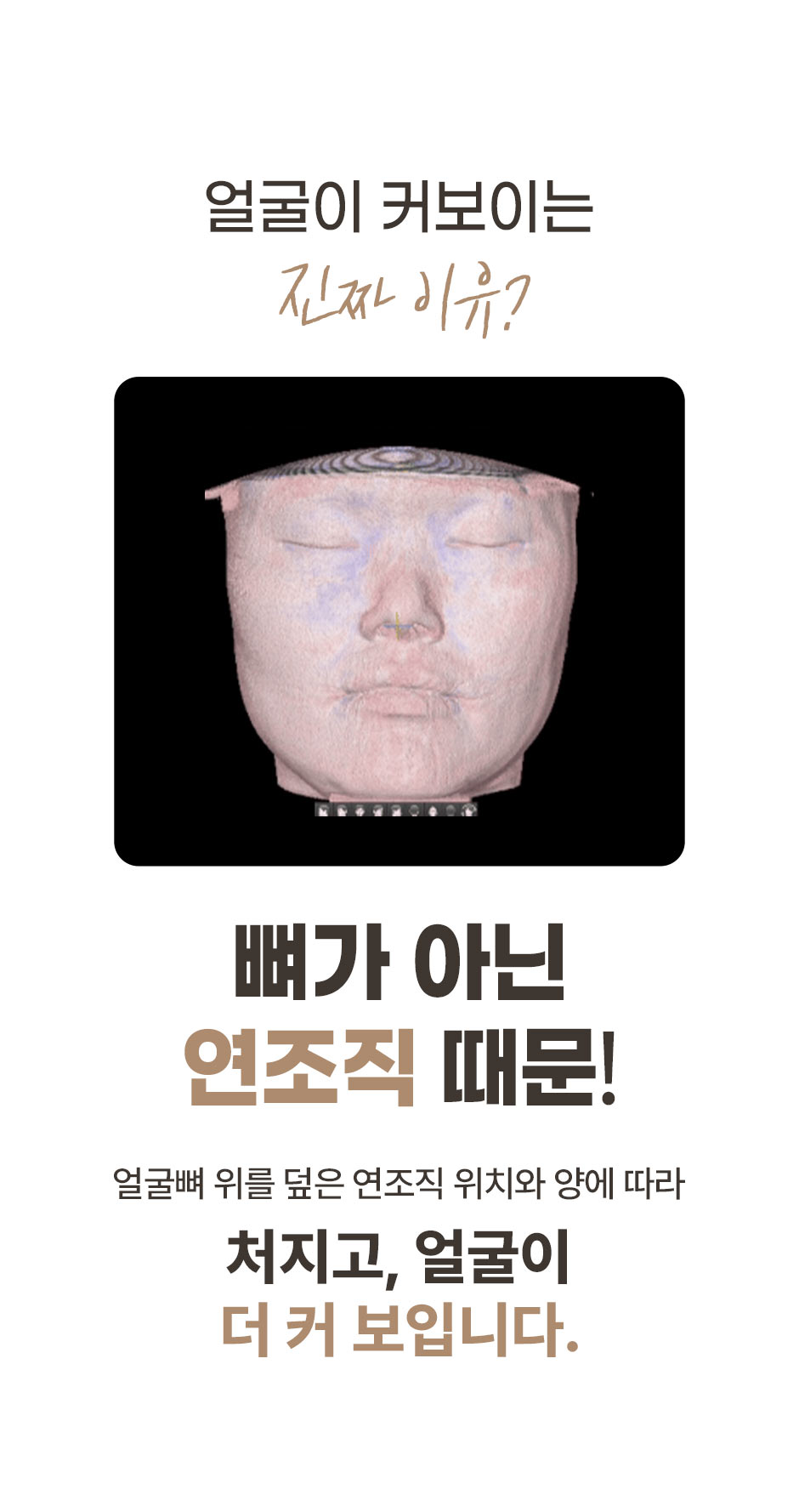연조직윤곽술_미인하이_02.jpg