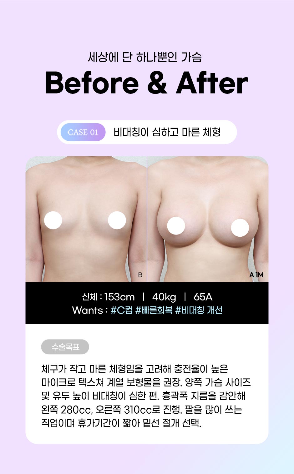 초개인화가슴성형_미인하이_03.jpg