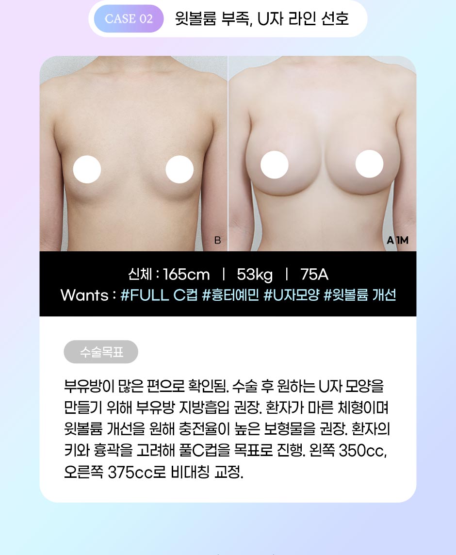 초개인화가슴성형_미인하이_04.jpg