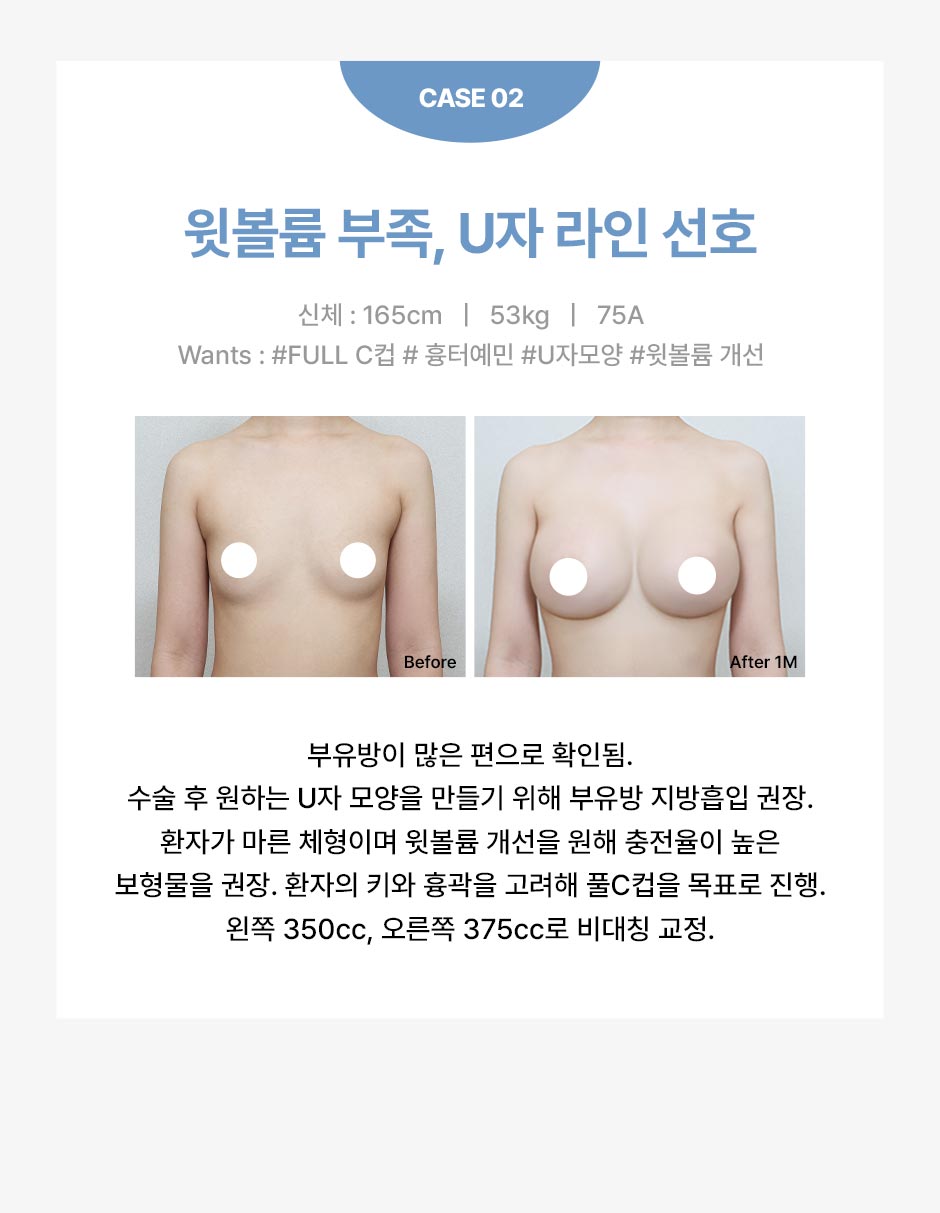 멘토가슴성형_미인하이_04.jpg