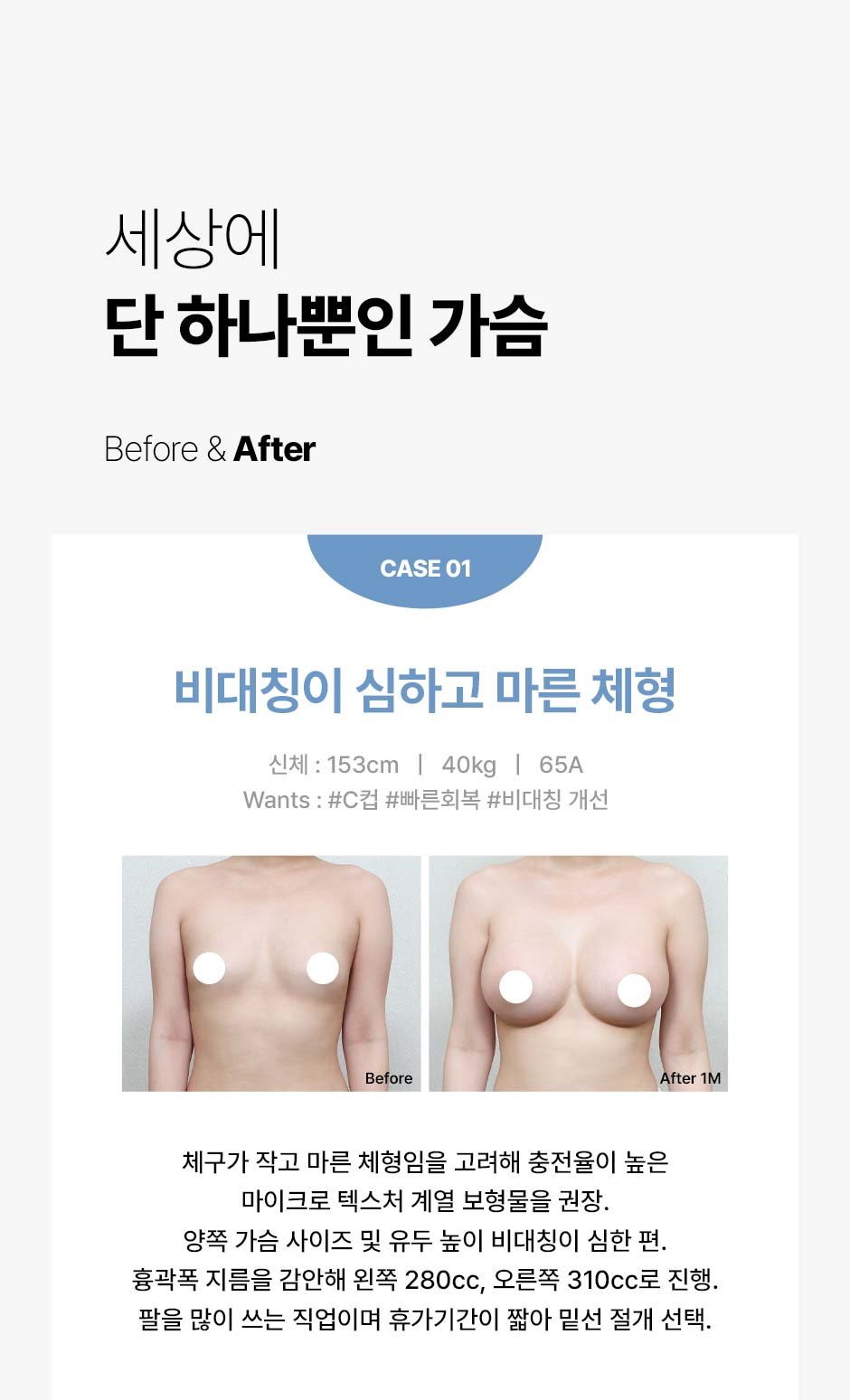 멘토가슴성형_미인하이_03.jpg