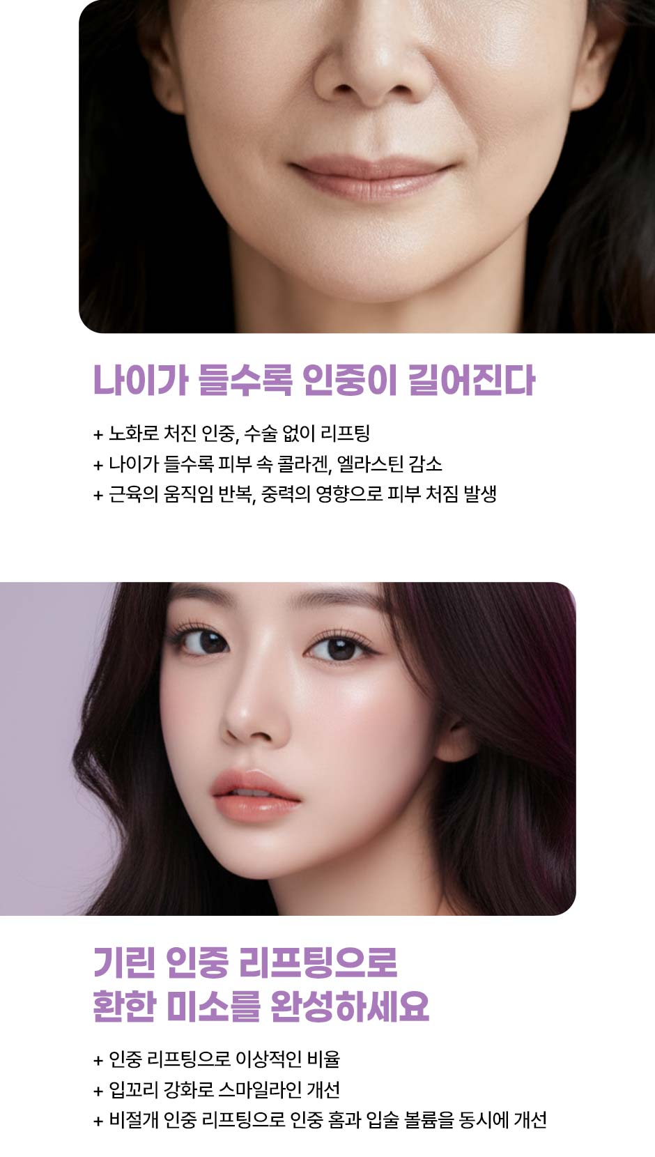 인중리프팅_미인하이_08.jpg