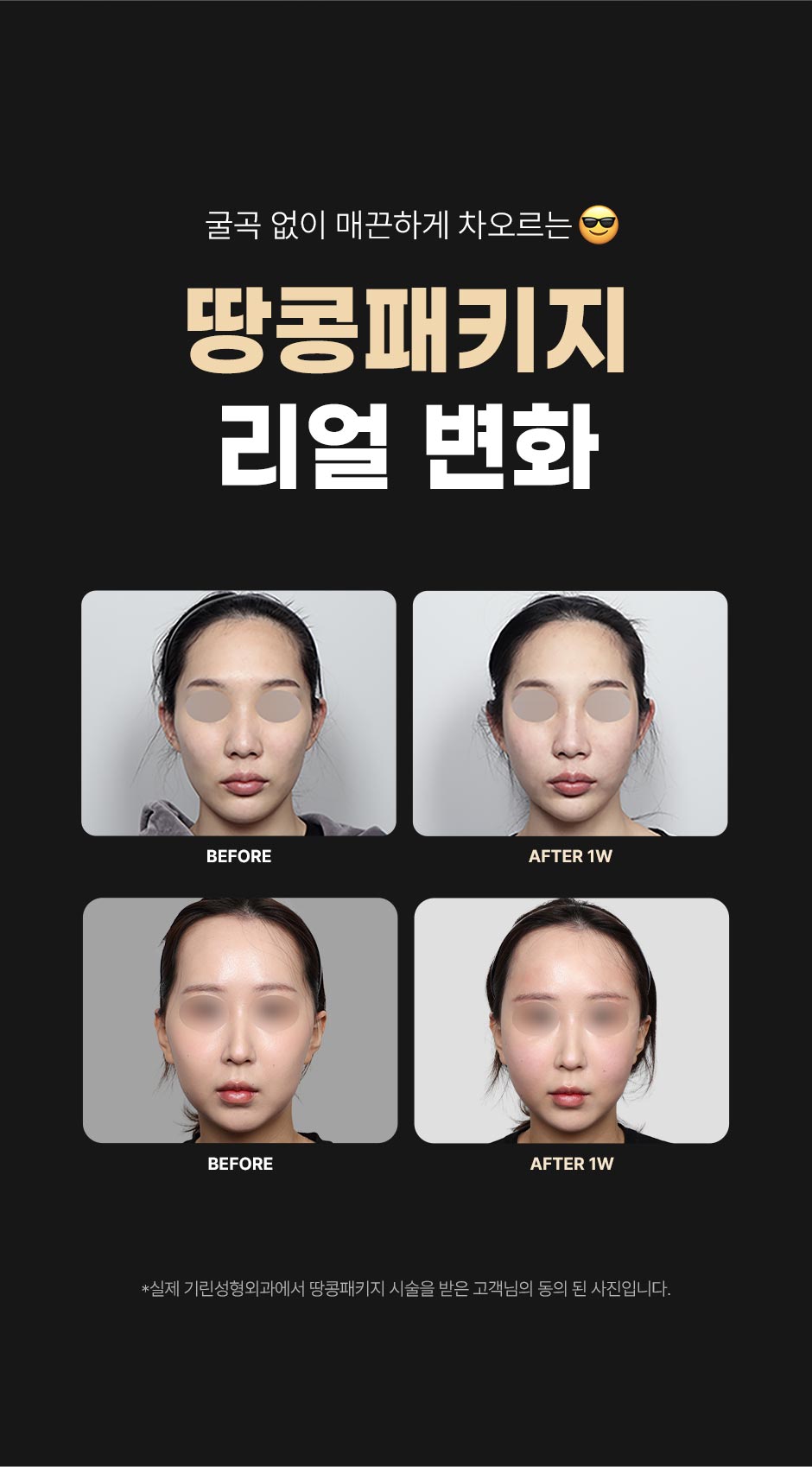 땅콩패키지_미인하이_07.jpg