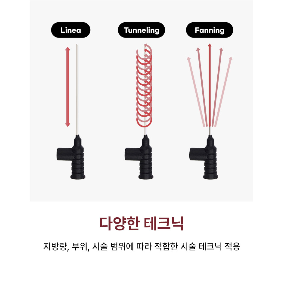 비절개눈밑지_미인하이_07.jpg