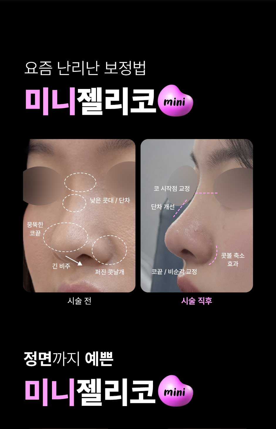 미니젤리코_미인하이_09.jpg