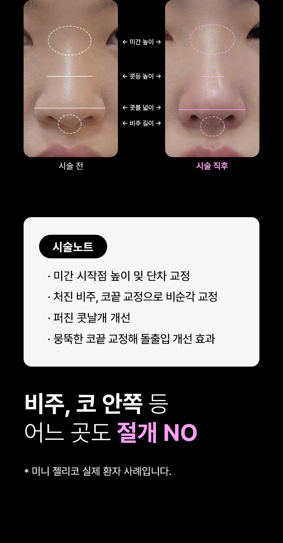 미니젤리코_미인하이_10.jpg