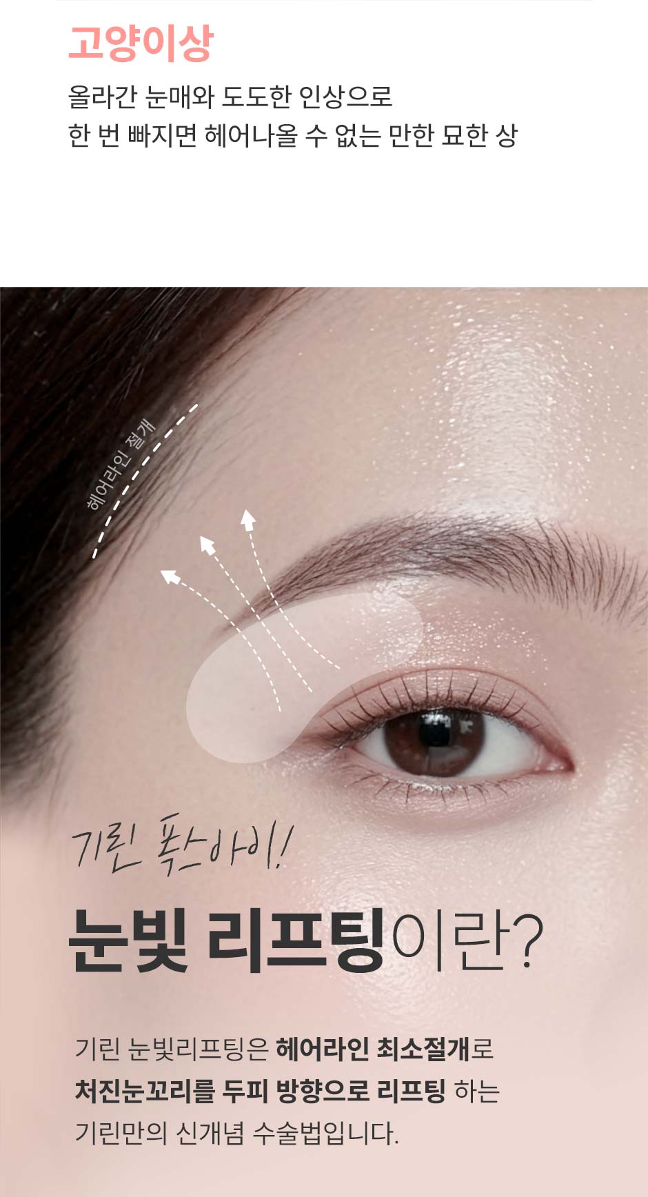 눈빛리프팅_미인하이_05.jpg