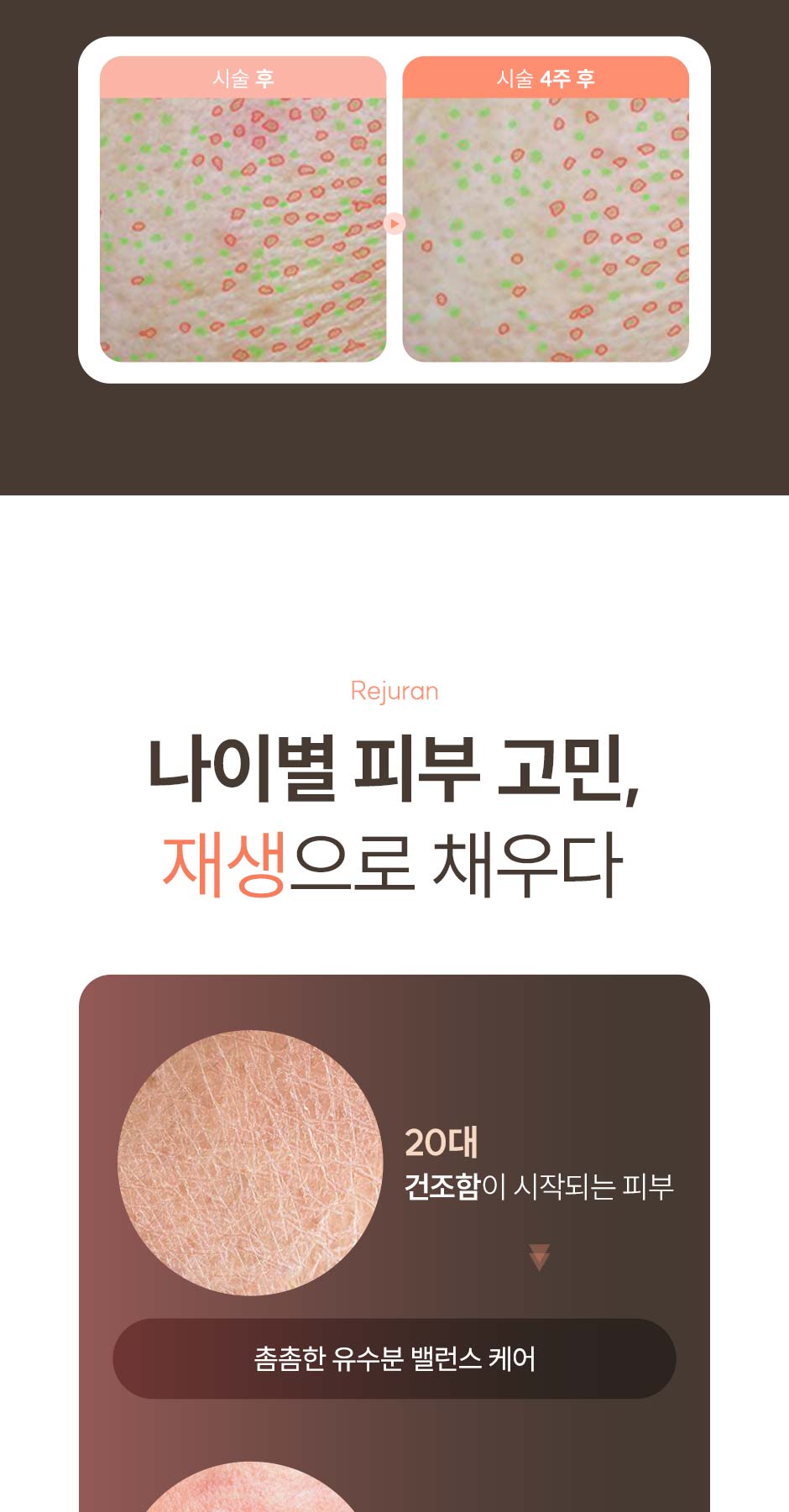 일요일-리쥬란_미인하이_06.jpg