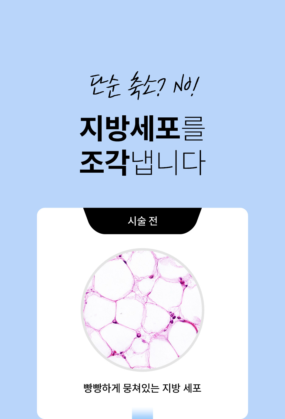 5세대갸름주사_미인하이_06.jpg