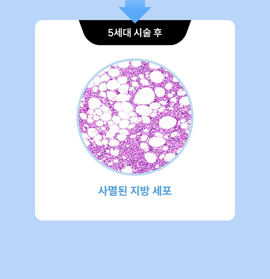 5세대갸름주사_미인하이_07.jpg