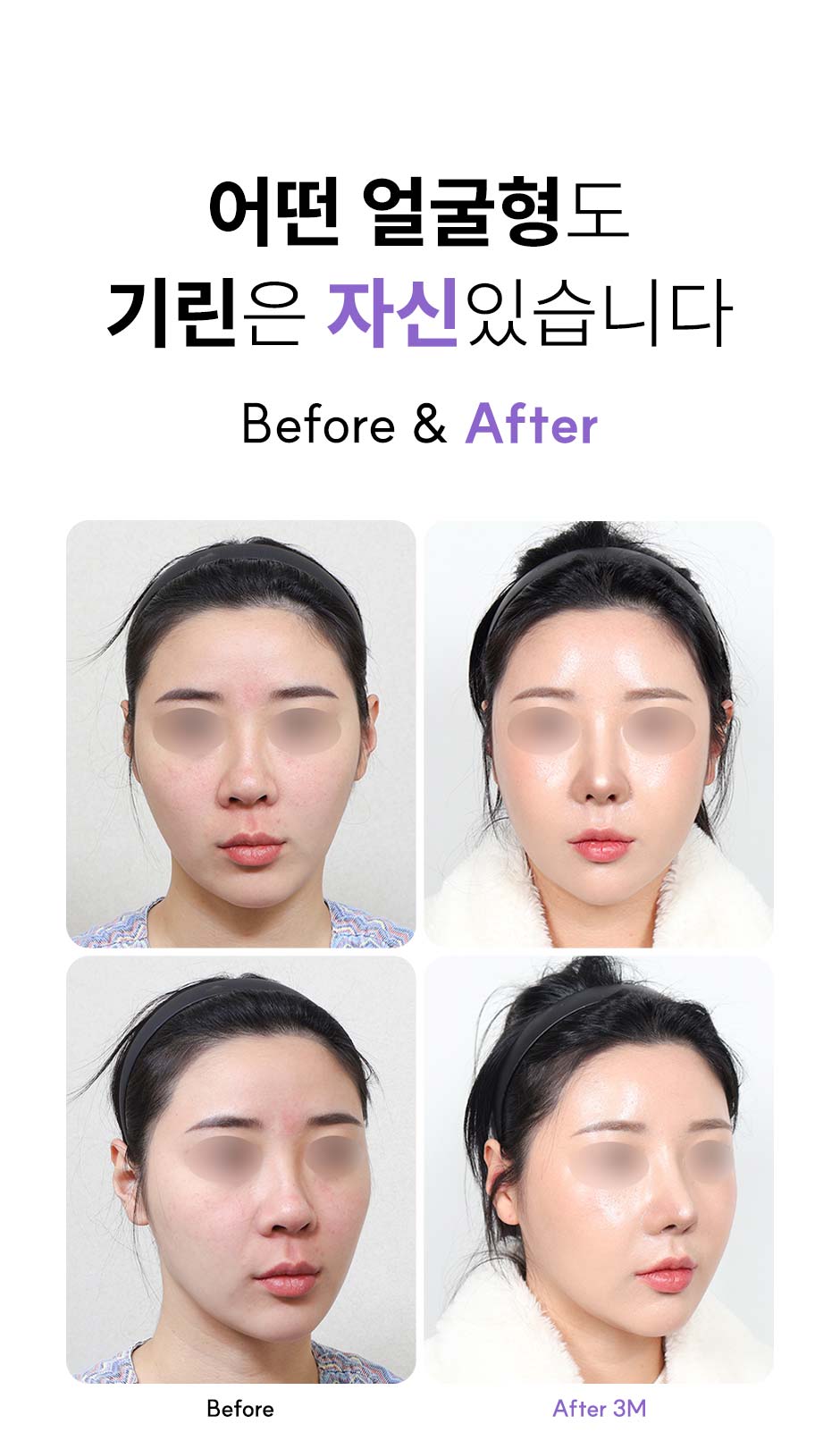 윤곽3종_미인하이_05.jpg