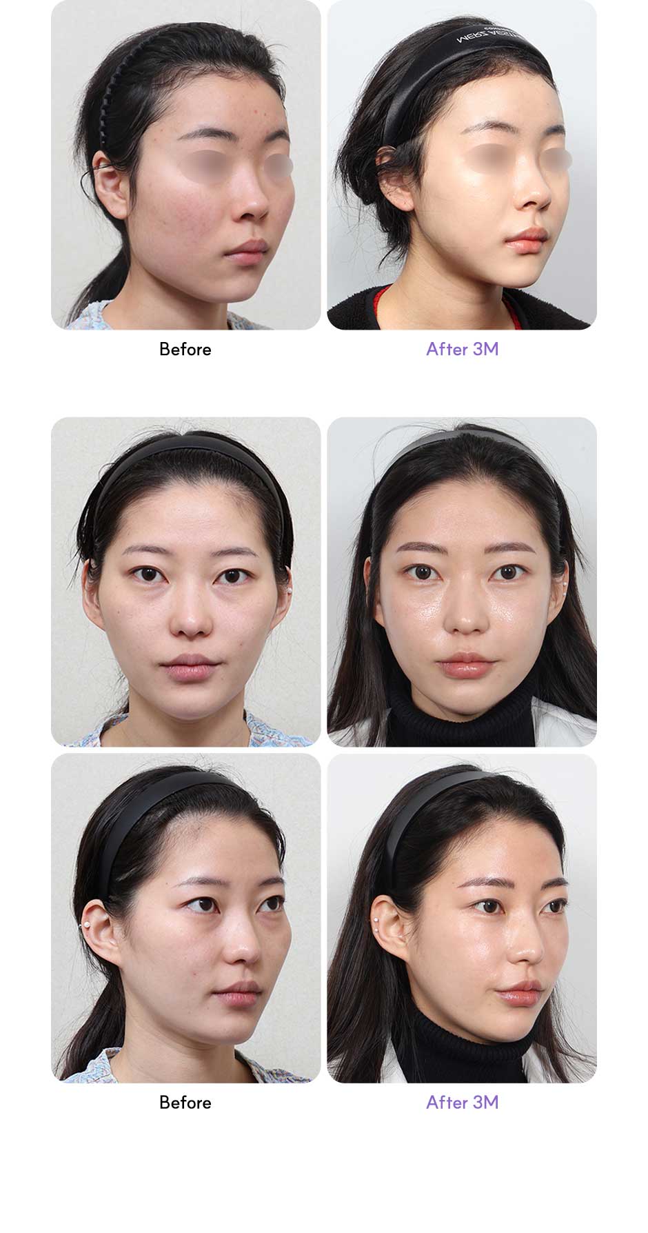 윤곽3종_미인하이_07.jpg