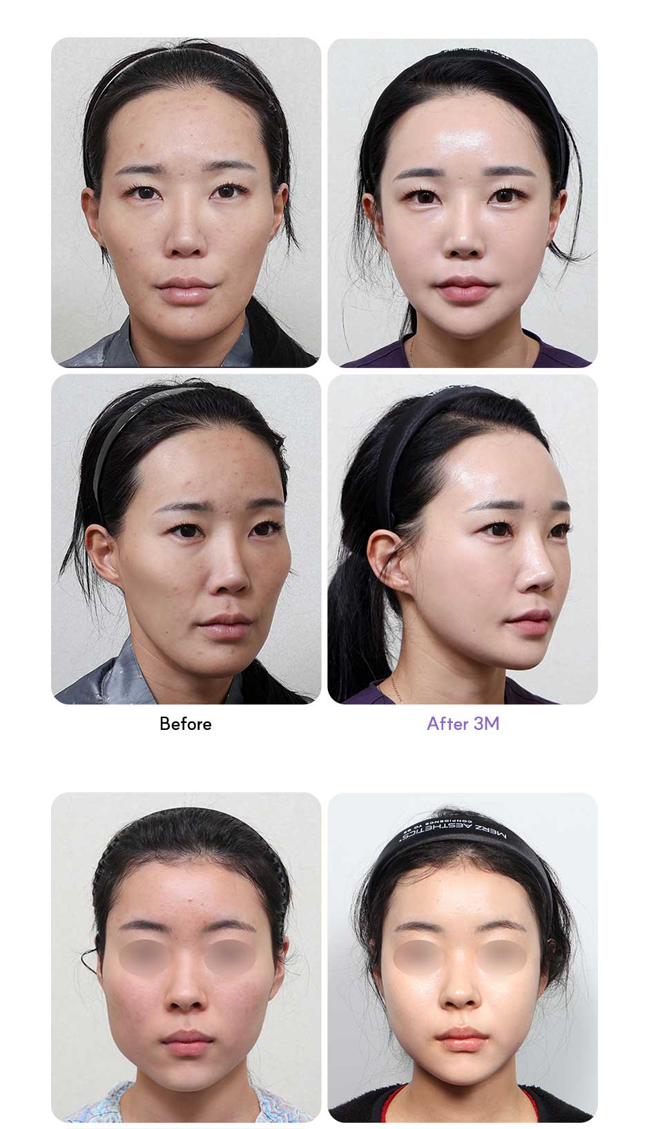 윤곽3종_미인하이_06.jpg