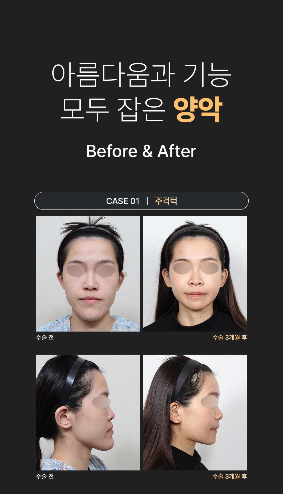 밀착양악_미인하이_03.jpg