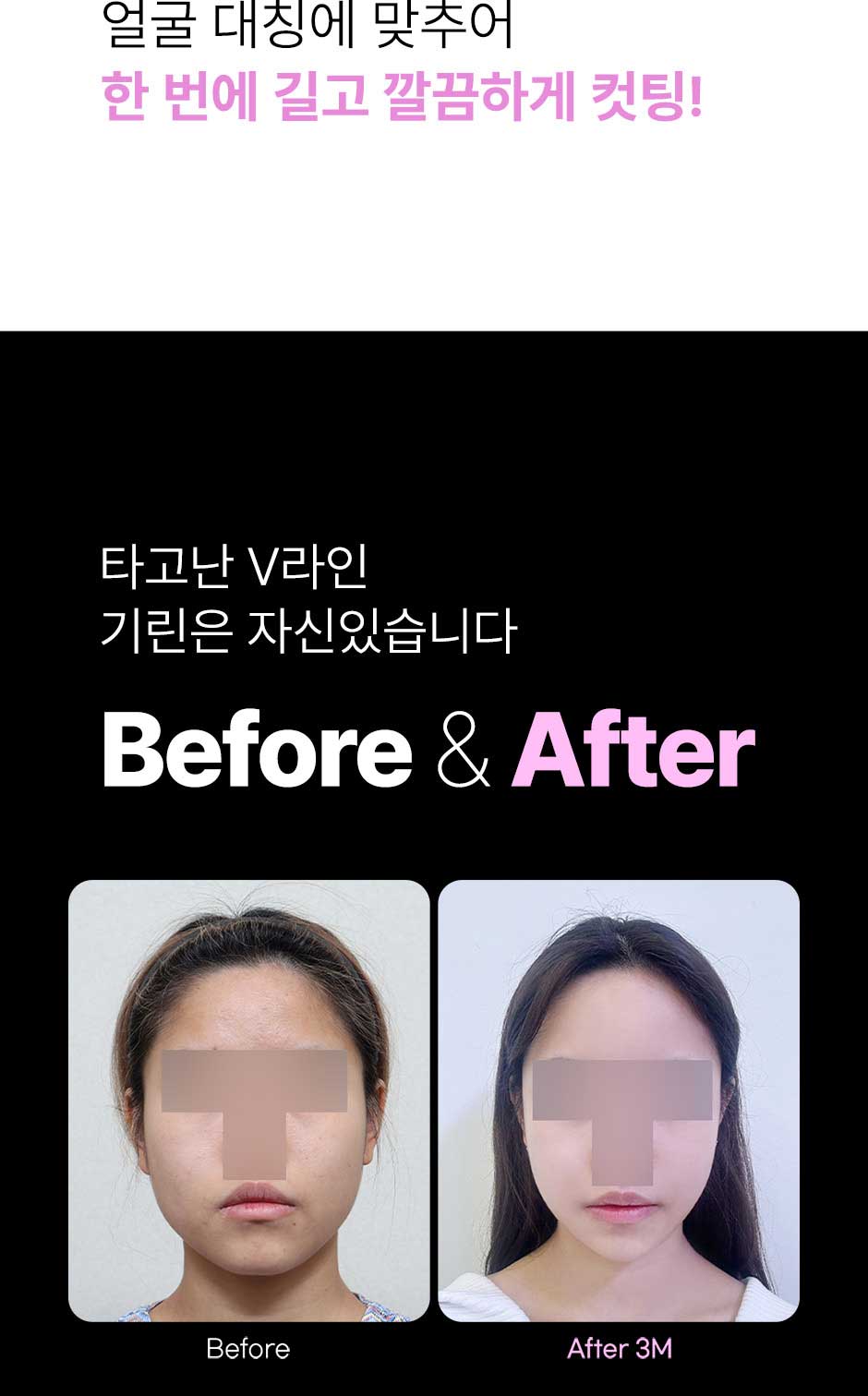 뉴V라인_미인하이_04.jpg