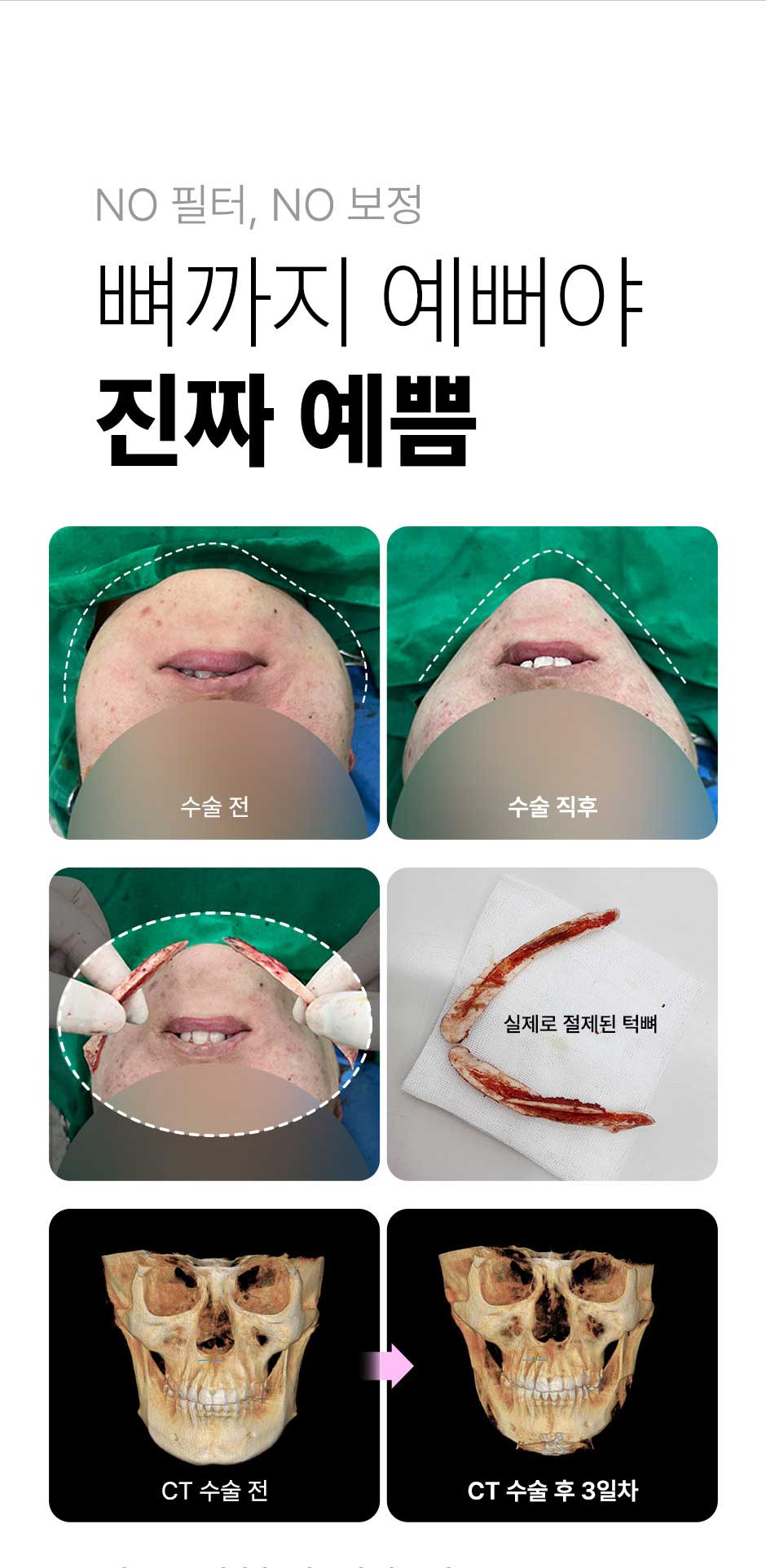 뉴V라인_미인하이_03.jpg