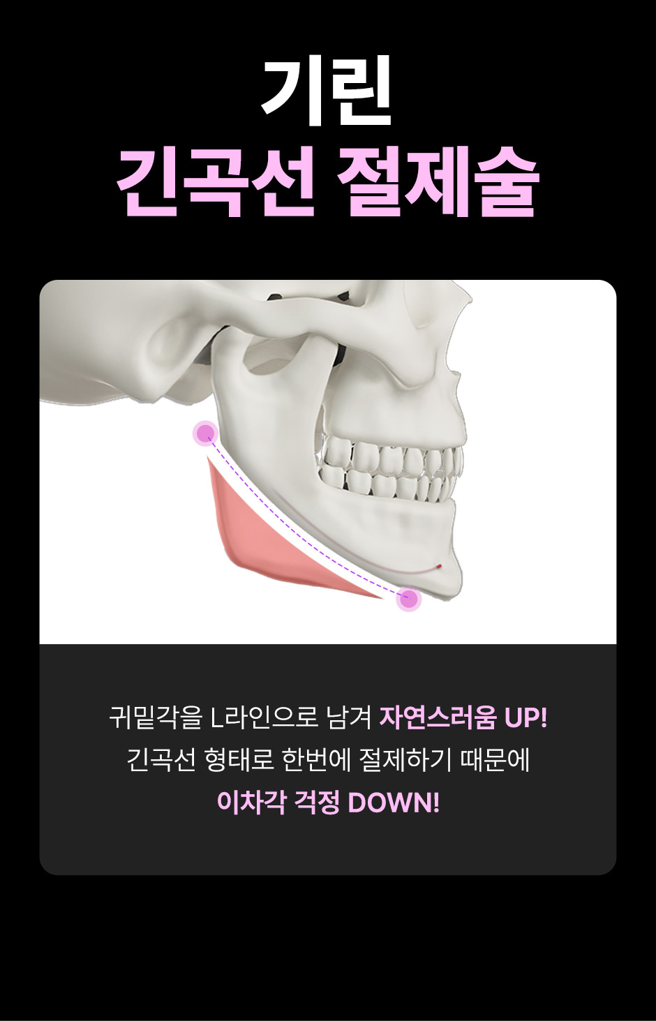 뉴V라인_미인하이_09.jpg