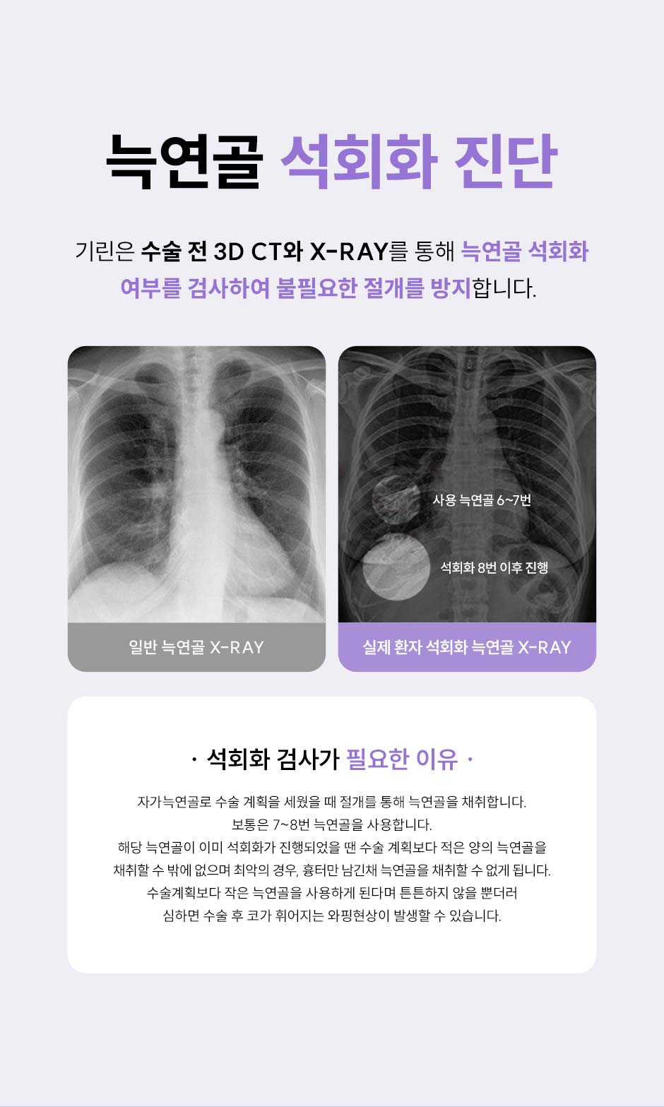 코재수술_미인하이_07.jpg