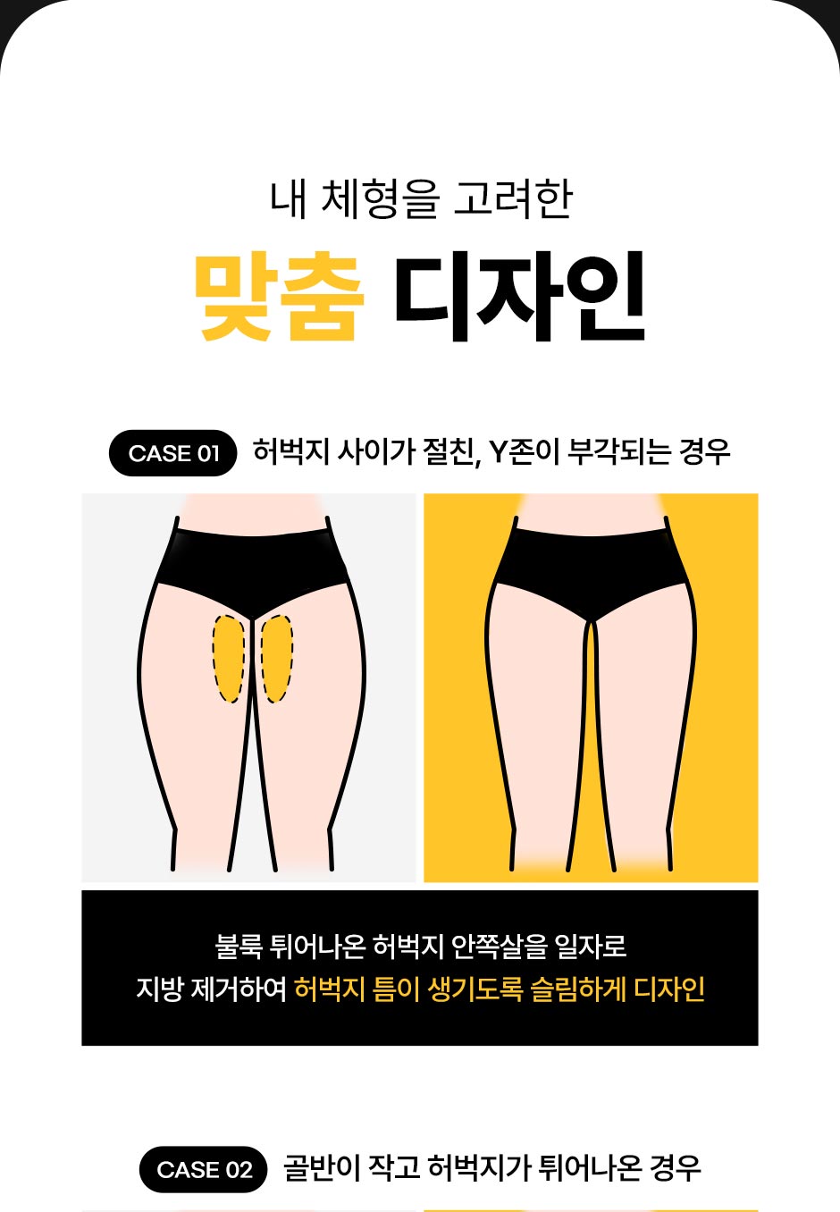 초음파뼈벅지지흡_07.jpg