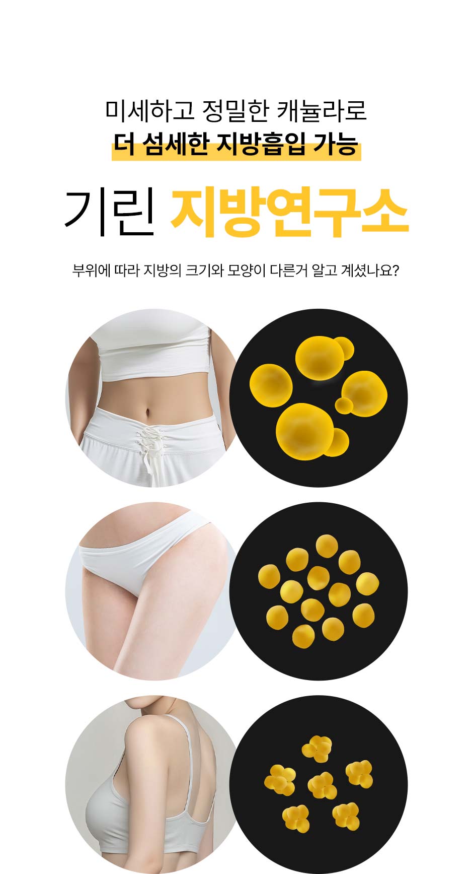 초음파뼈벅지지흡_12.jpg