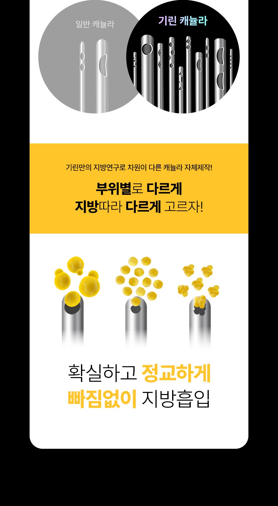 초음파뼈벅지지흡_14.jpg