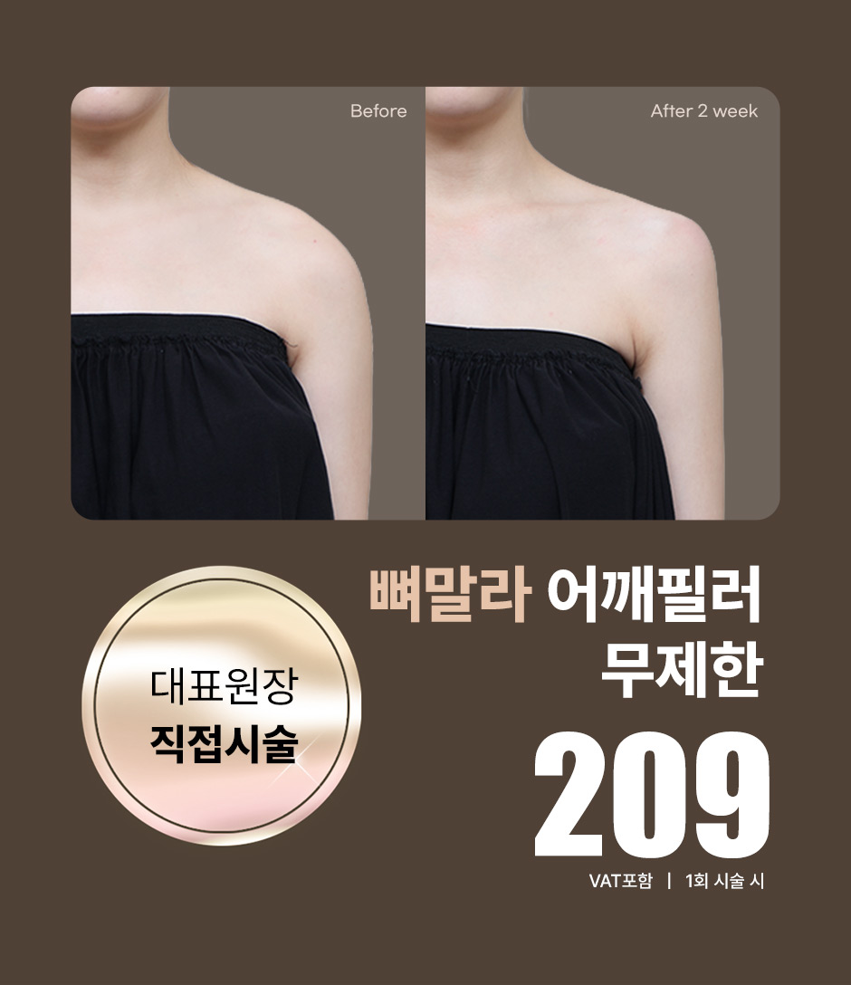 어깨필러_미인하이_01.jpg