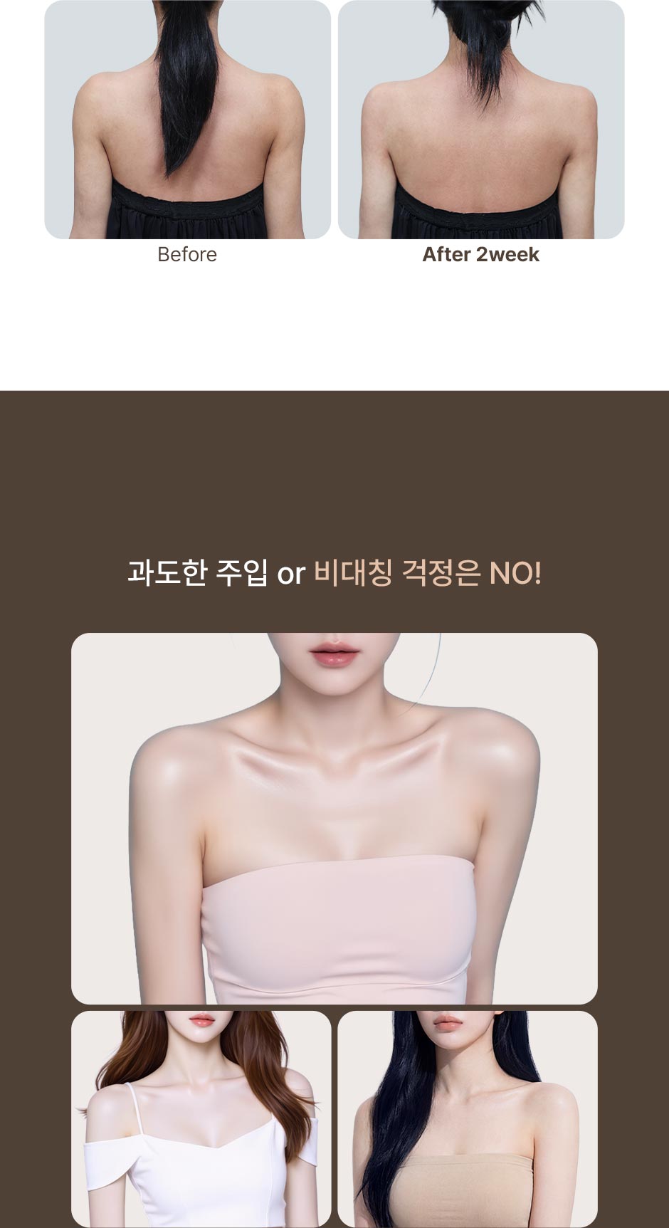 어깨필러_미인하이_06.jpg