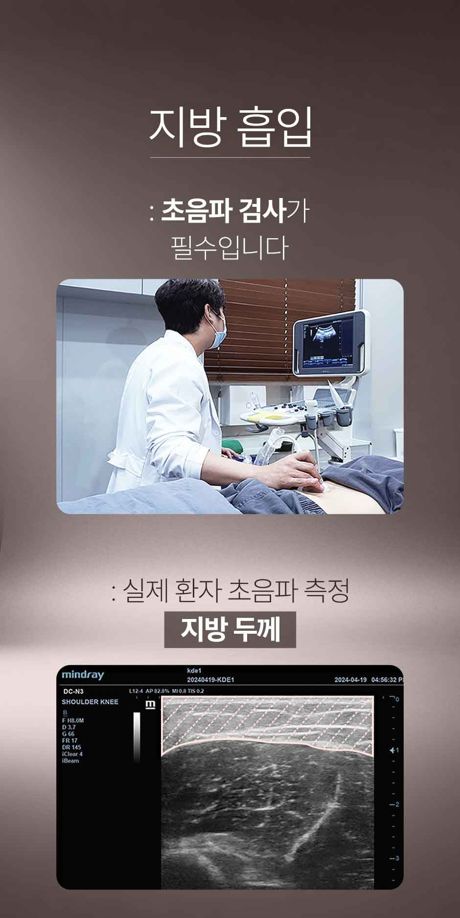 복부전체지방흡입_미인하이_04.jpg