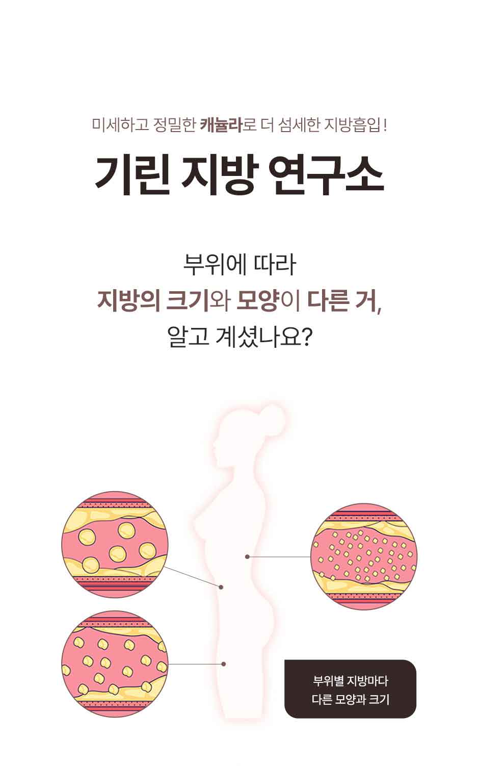 복부전체지방흡입_미인하이_14.jpg