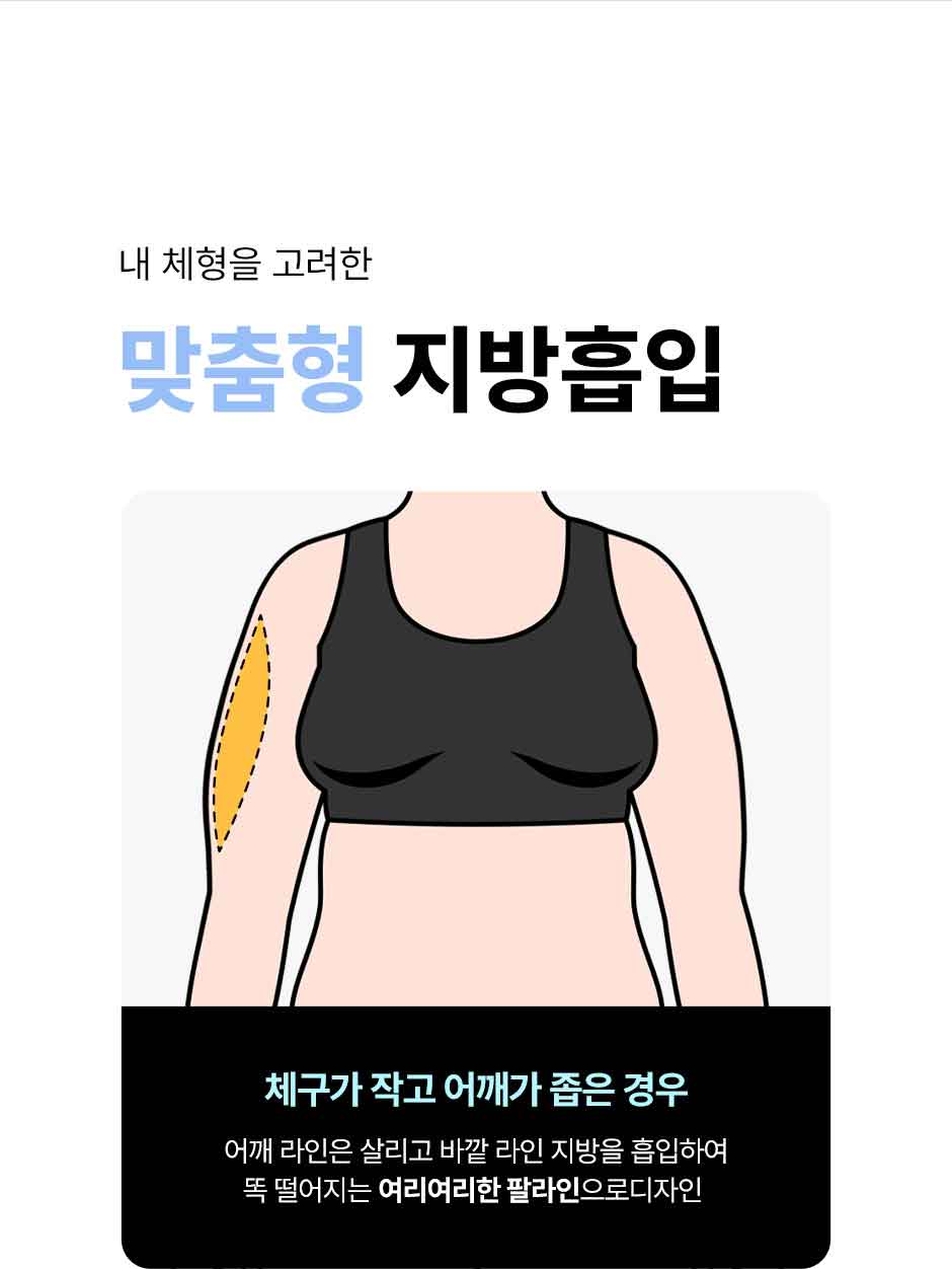 뼈말라팔뚝지방흡입_미인하이_10.jpg