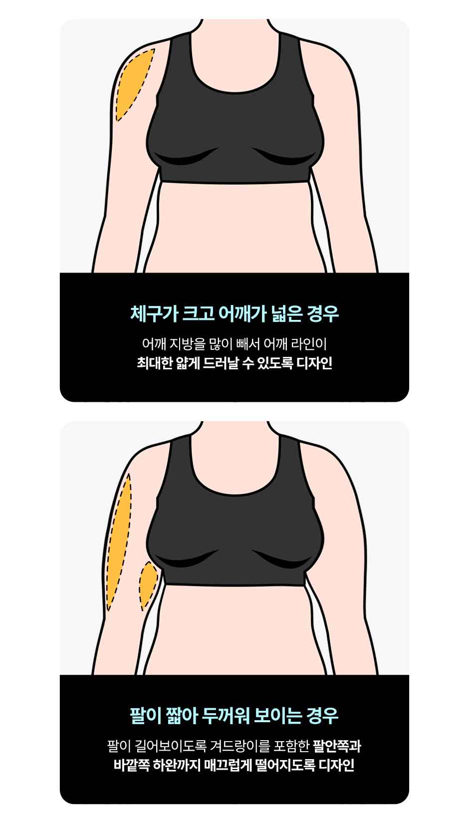 뼈말라팔뚝지방흡입_미인하이_11.jpg