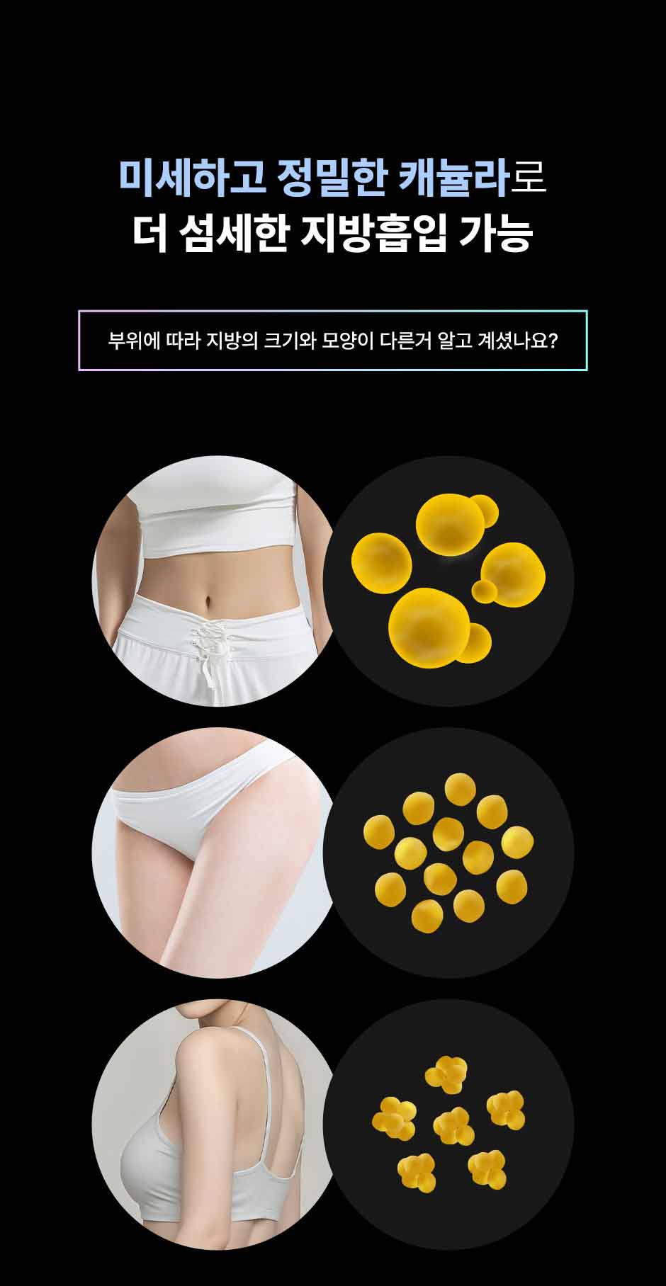 뼈말라팔뚝지방흡입_미인하이_15.jpg
