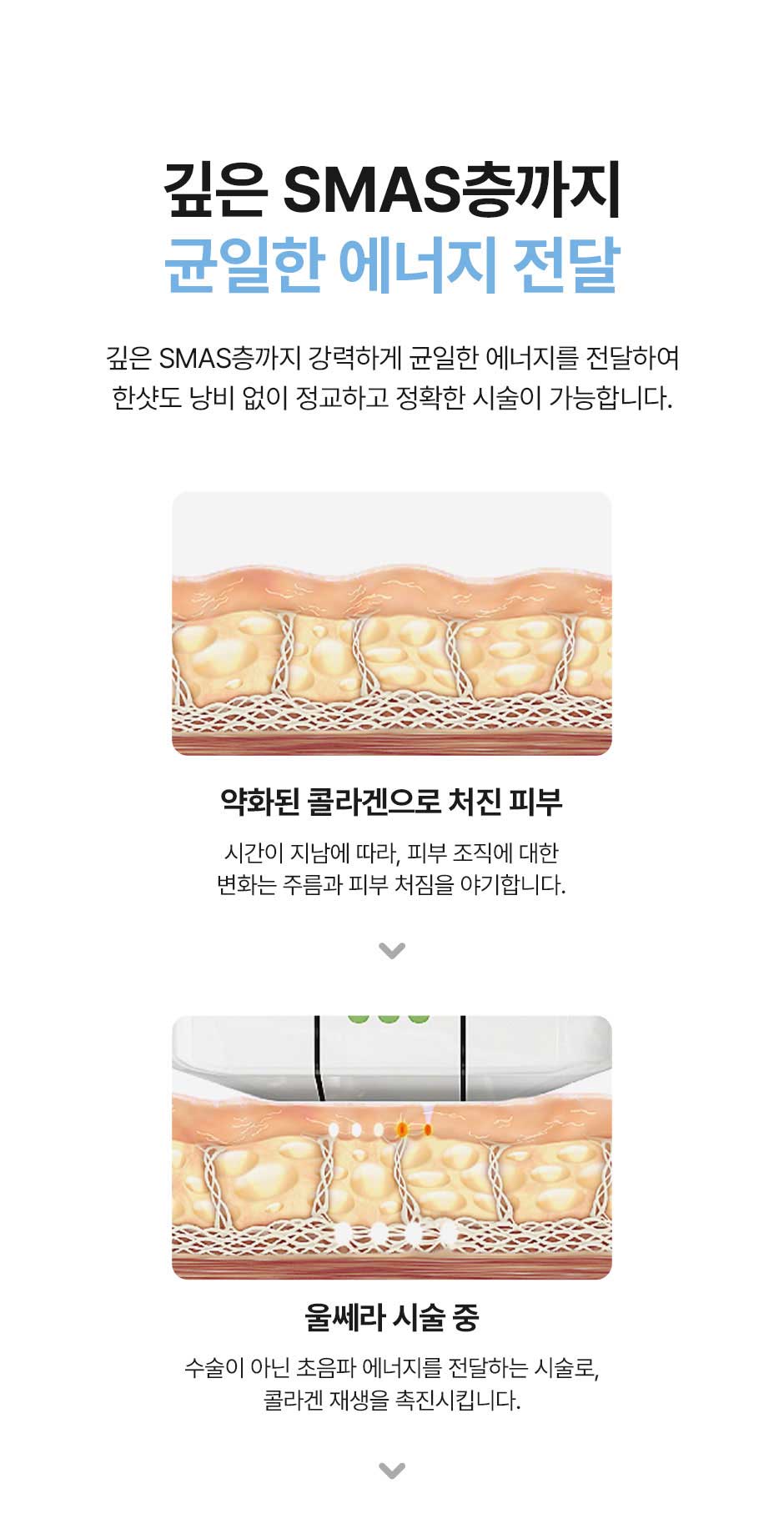 일요일울쎄라_미인하이_12.jpg