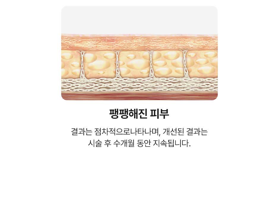 일요일울쎄라_미인하이_13.jpg