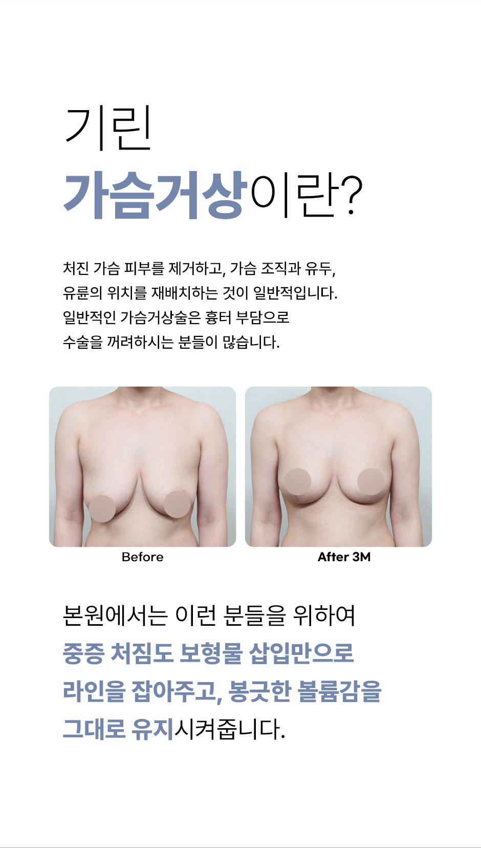 가슴거상_미인하이_04.jpg