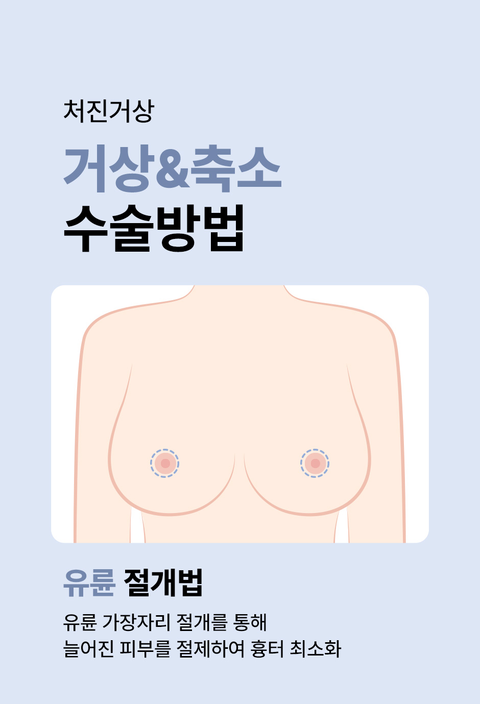 가슴거상_미인하이_07.jpg