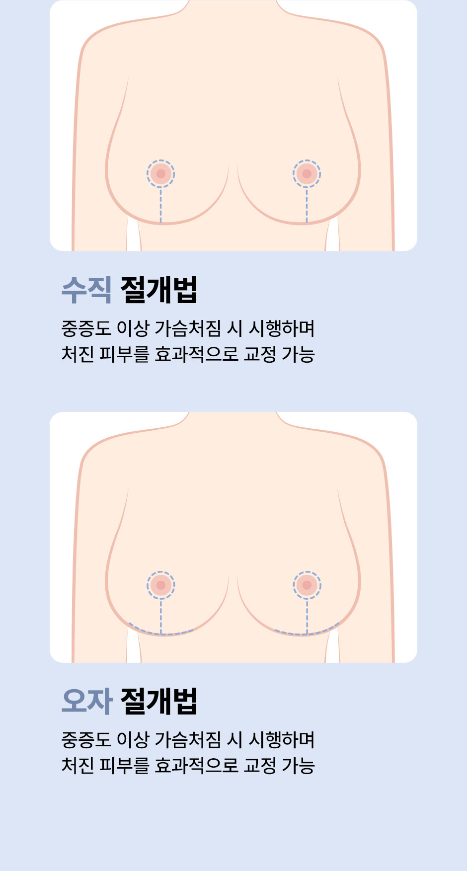 가슴거상_미인하이_08.jpg