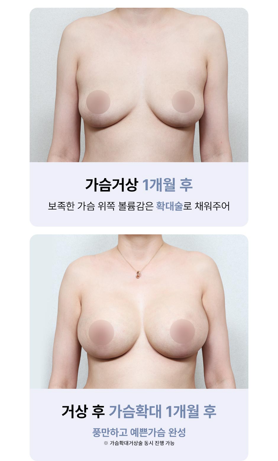 가슴거상_미인하이_12.jpg