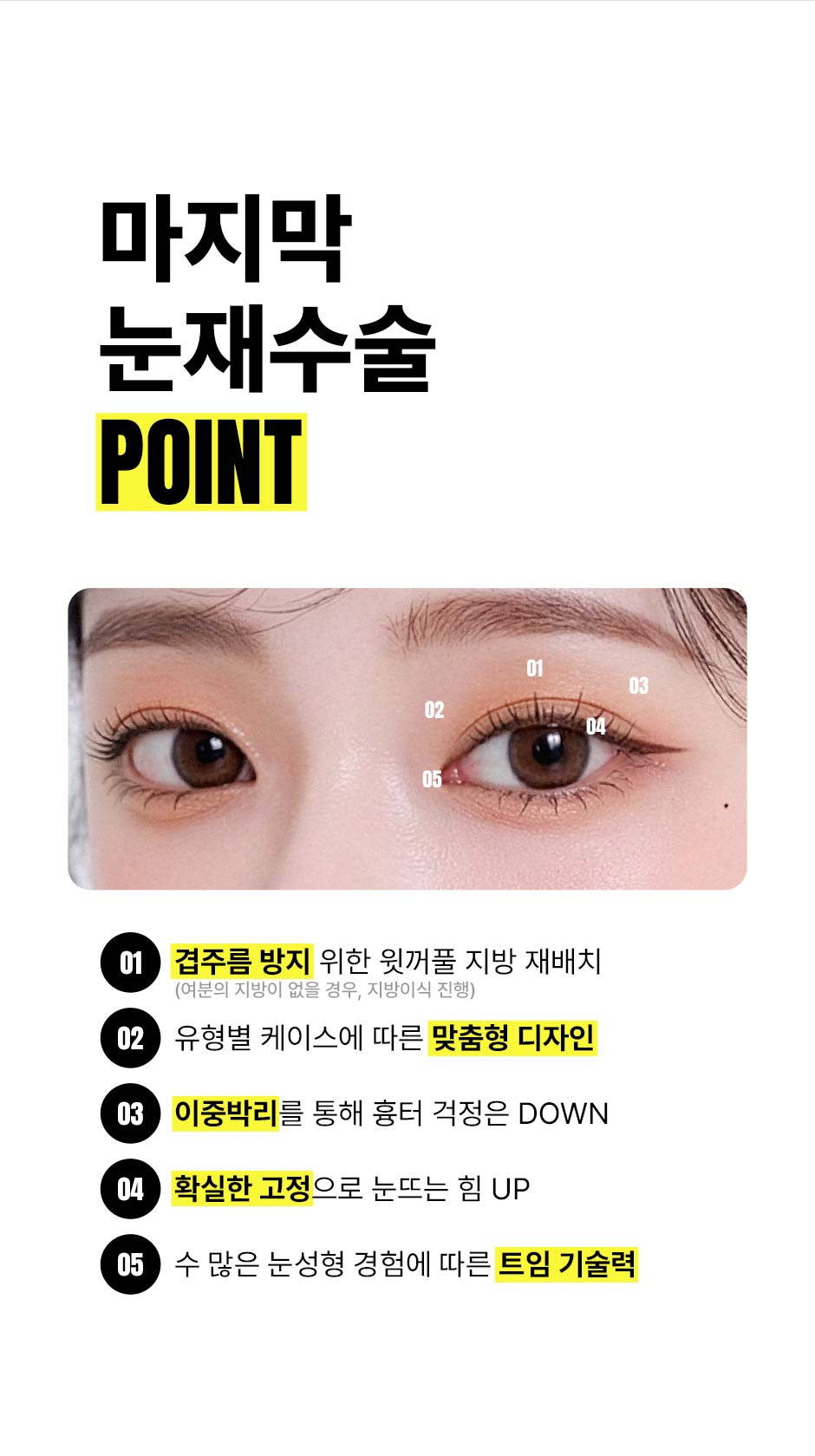 눈재수술_미인하이_08.jpg