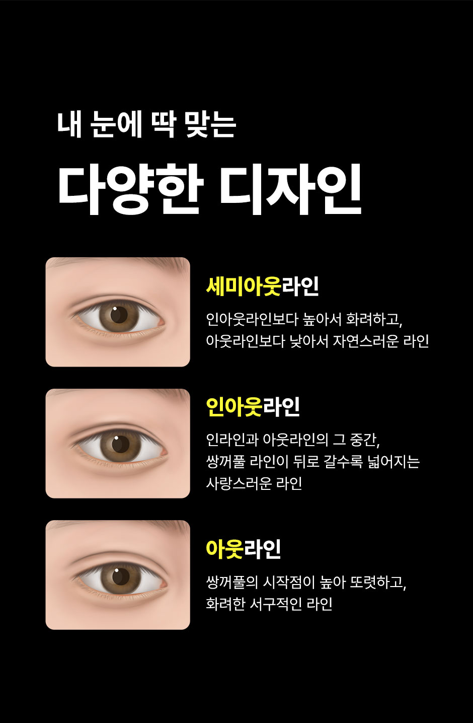 눈재수술_미인하이_09.jpg
