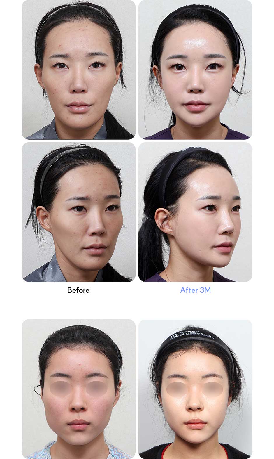 윤곽1종_미인하이_06.jpg