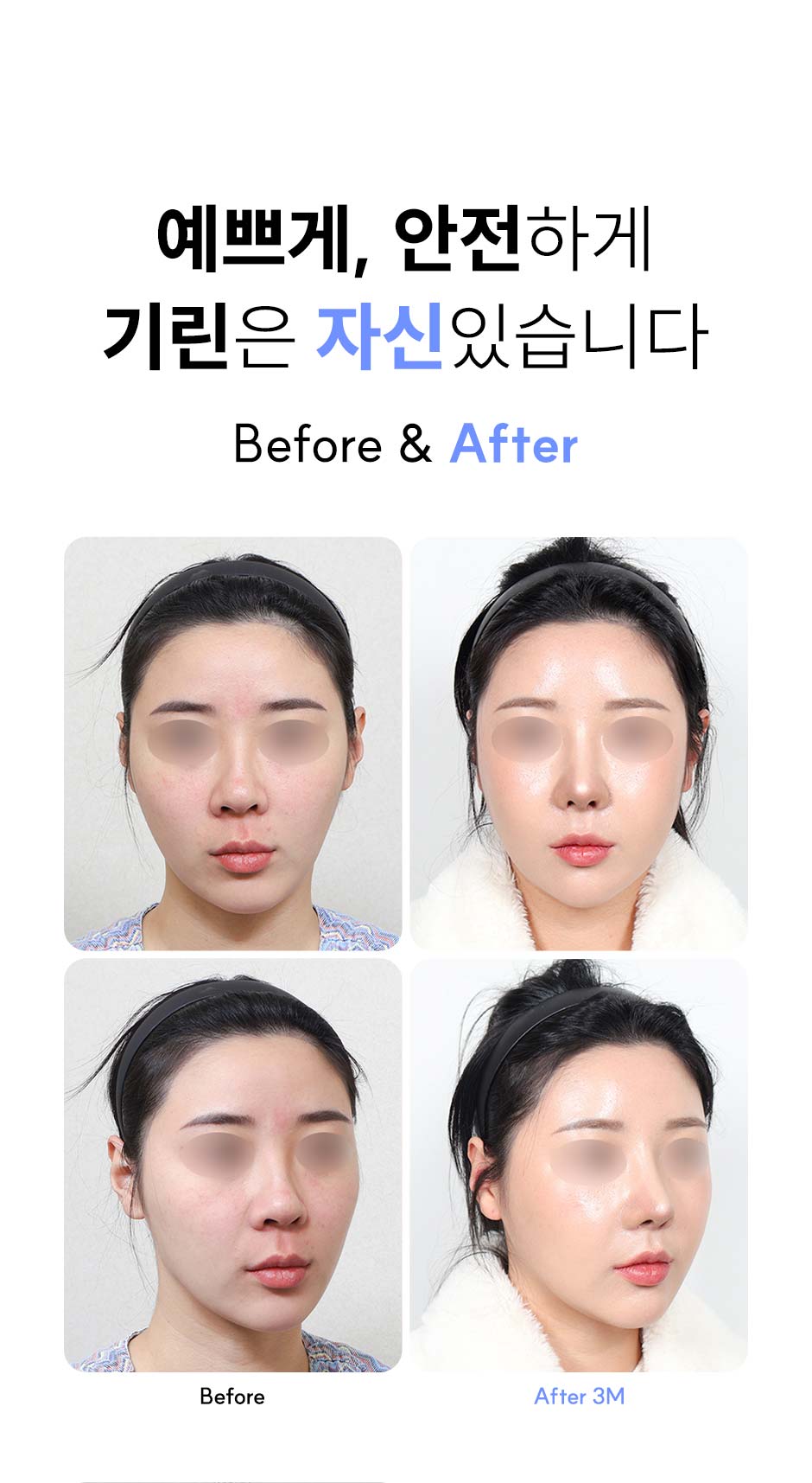 윤곽1종_미인하이_05.jpg