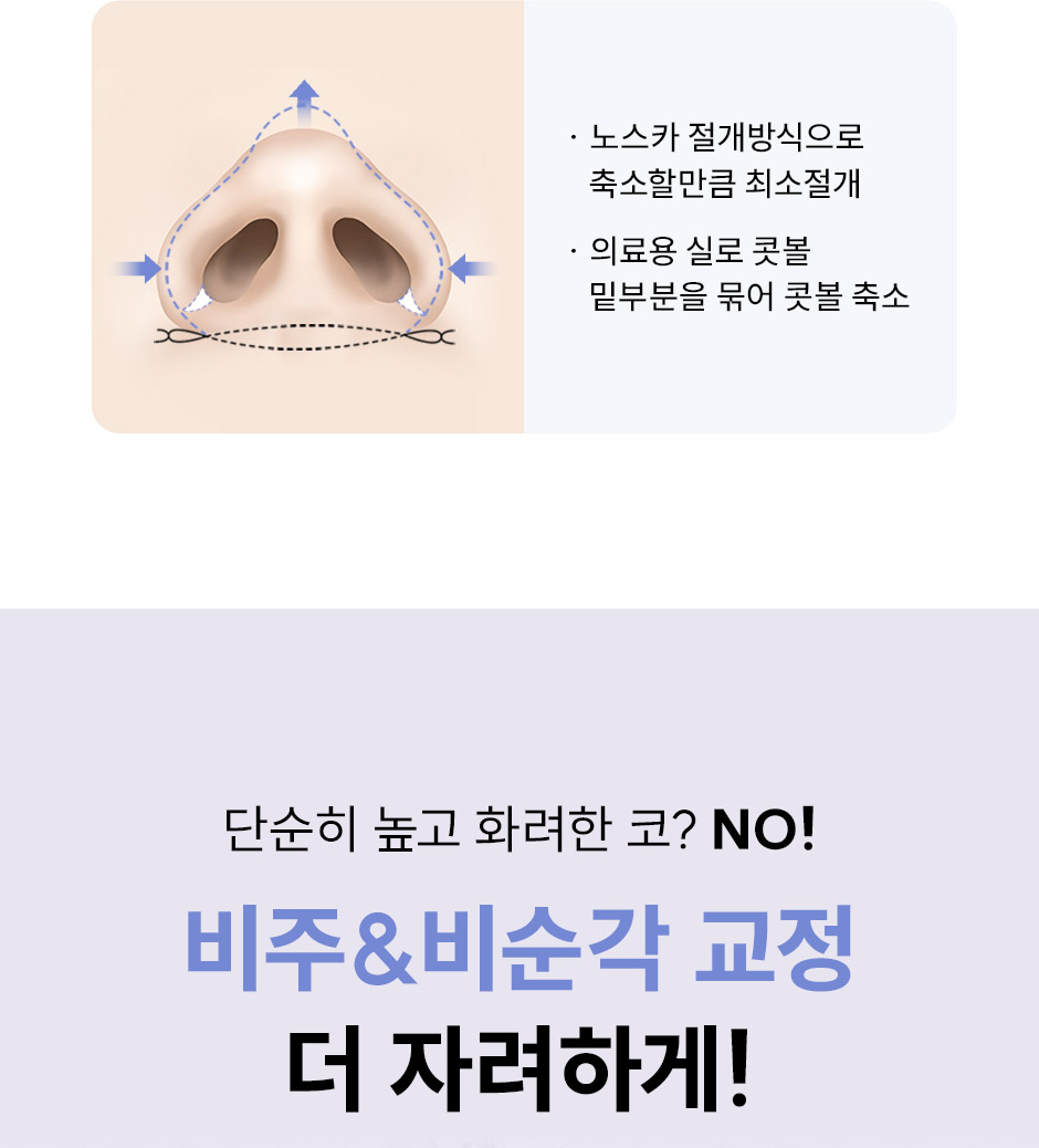 첫코성형_미인하이_05.jpg