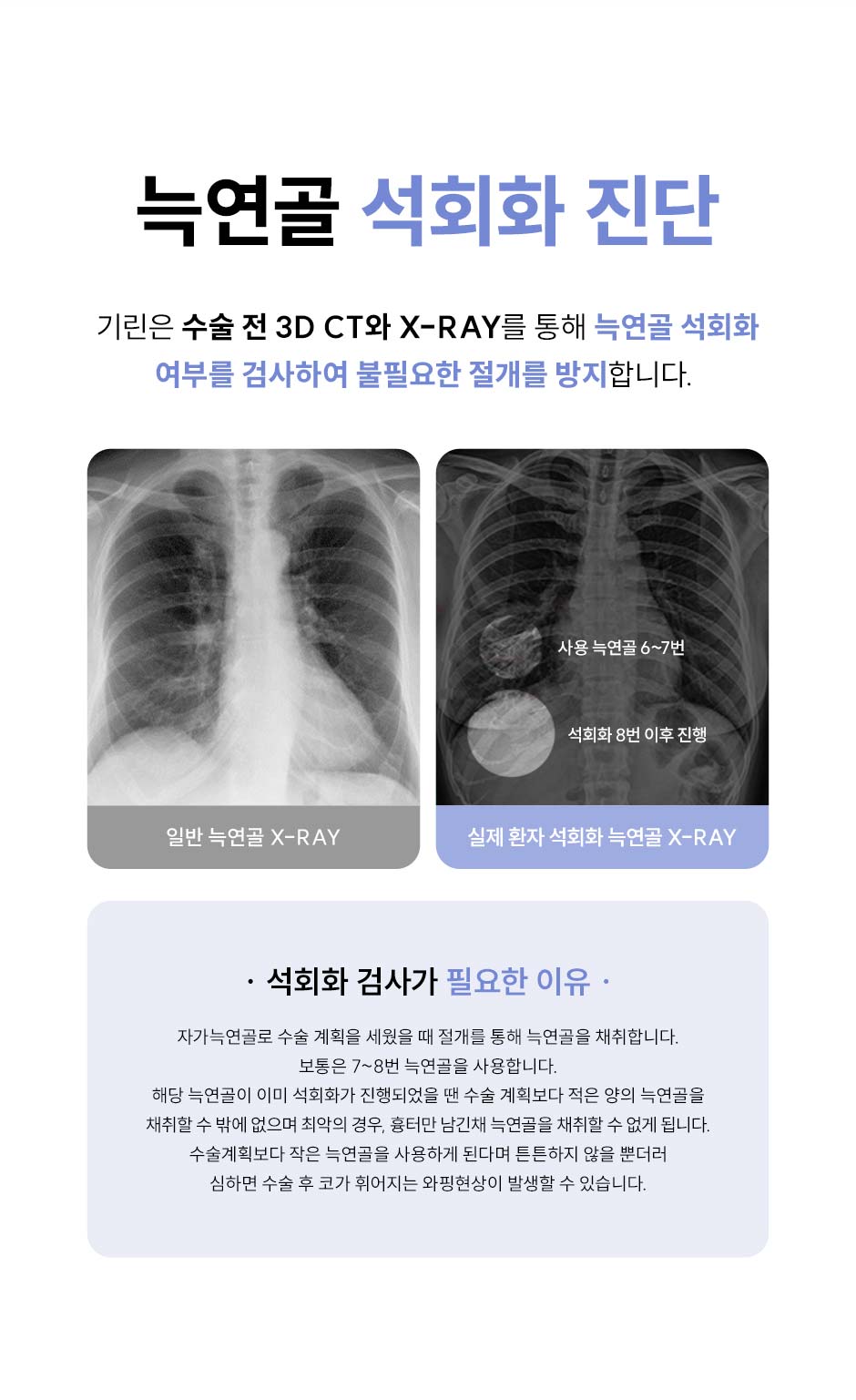 첫코성형_미인하이_12.jpg