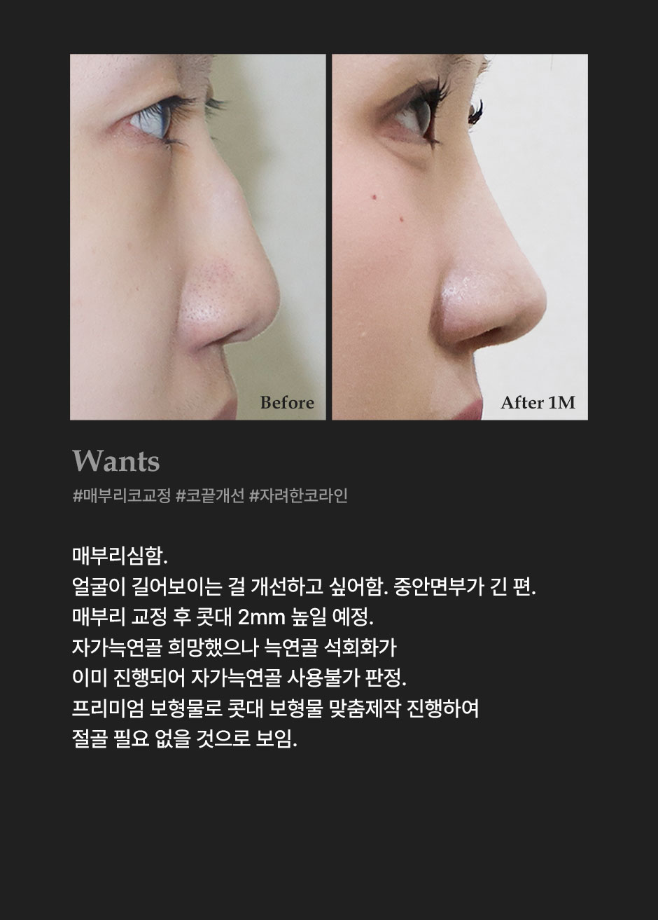프리미엄보형물_미인하이_05.jpg
