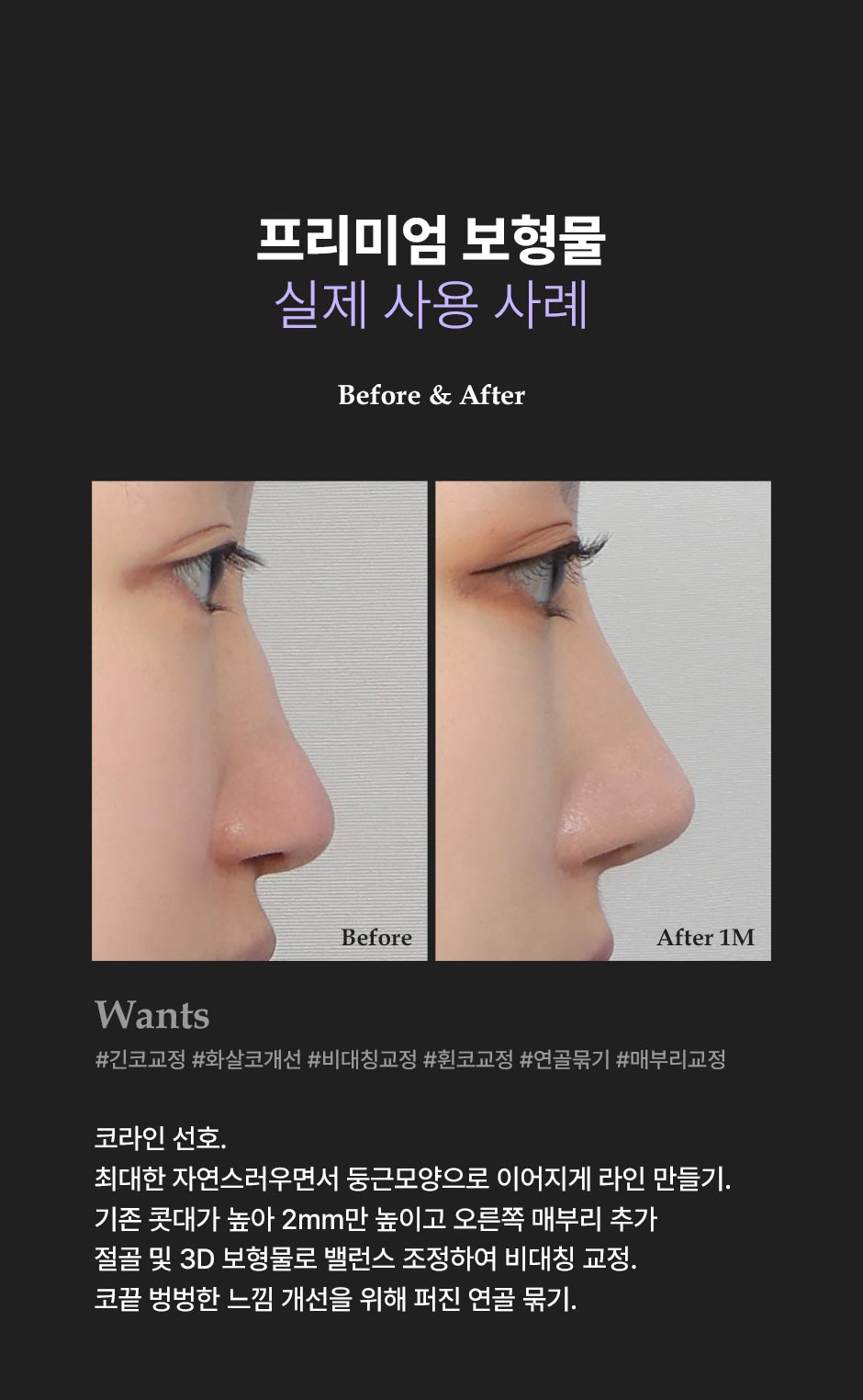 프리미엄보형물_미인하이_04.jpg