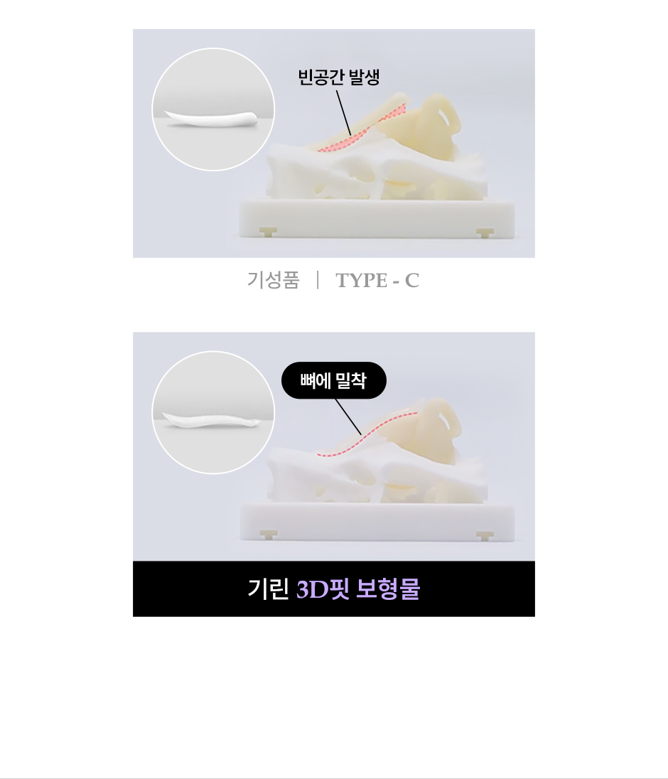 프리미엄보형물_미인하이_03.jpg
