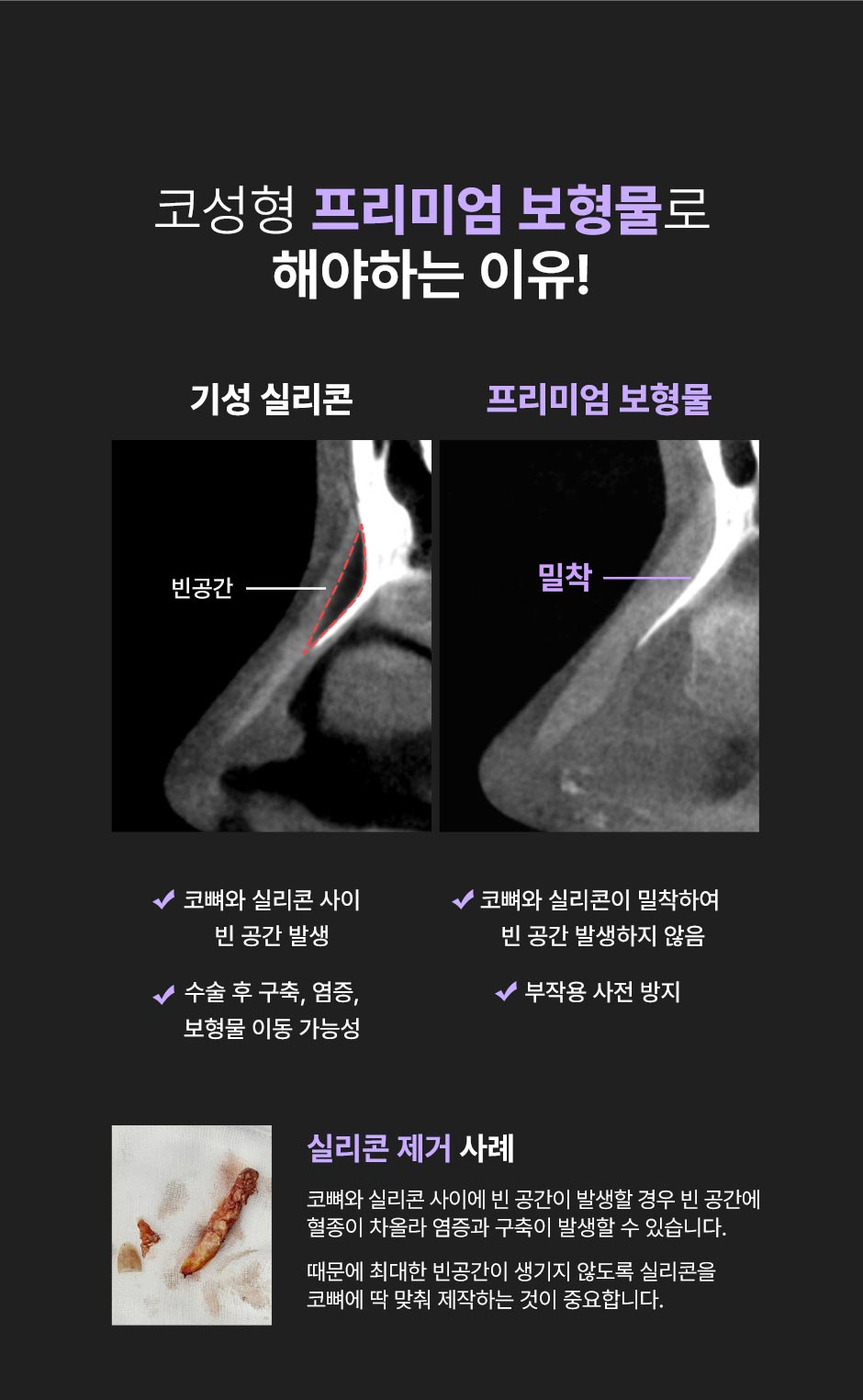 프리미엄보형물_미인하이_08.jpg