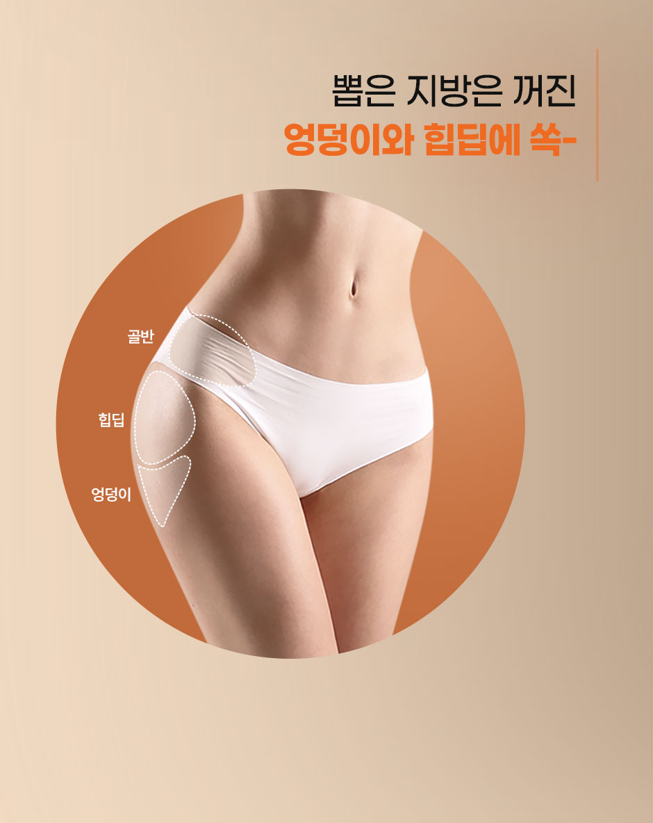 엉발란스_미인하이_03.jpg
